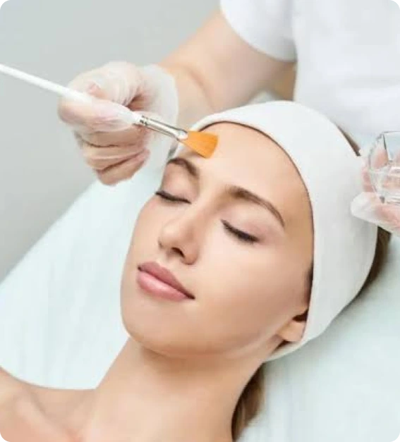 Chemical peel