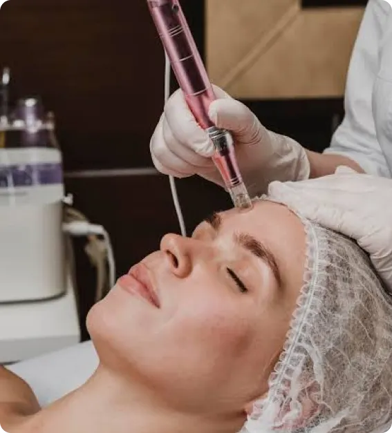 Microneedling