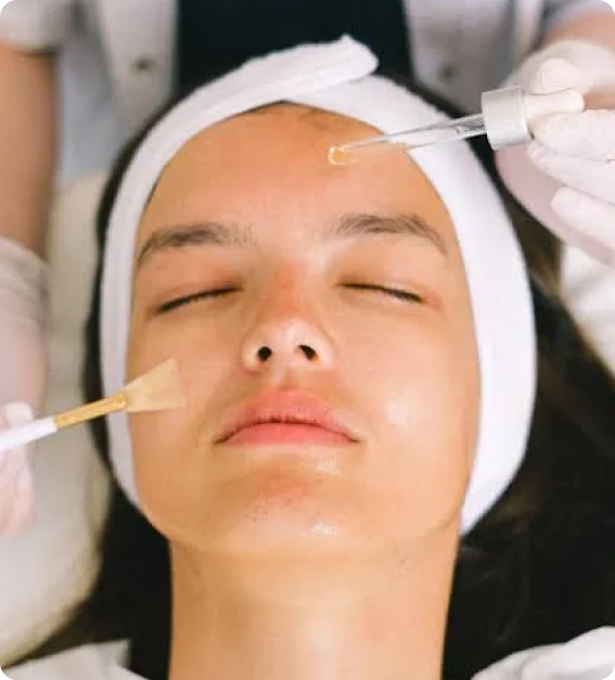 Photo facial